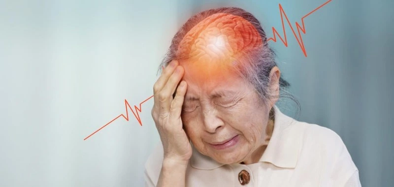 apa itu stroke